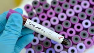 Lee más sobre el artículo Museos de la UNC suspenden visitas por el Coronavirus