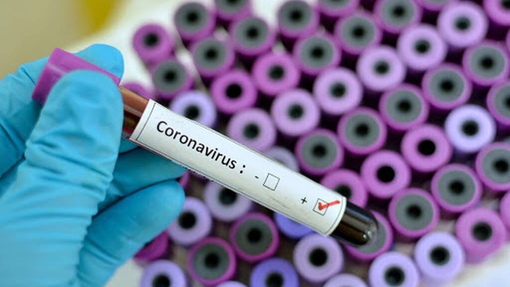 En este momento estás viendo Museos de la UNC suspenden visitas por el Coronavirus
